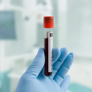 Laborröhrchen mit Blut