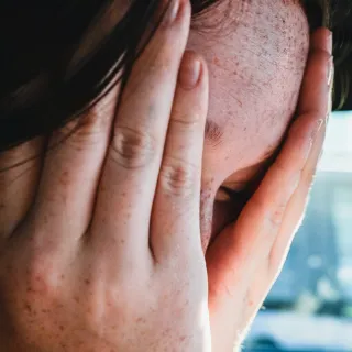 Frau mit Sommersprossen hält sich die Hände vor das Gesicht