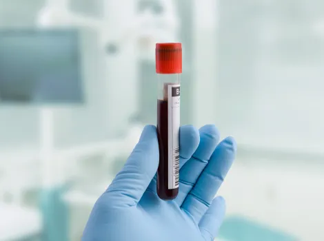 Blut in einem Laborrohr